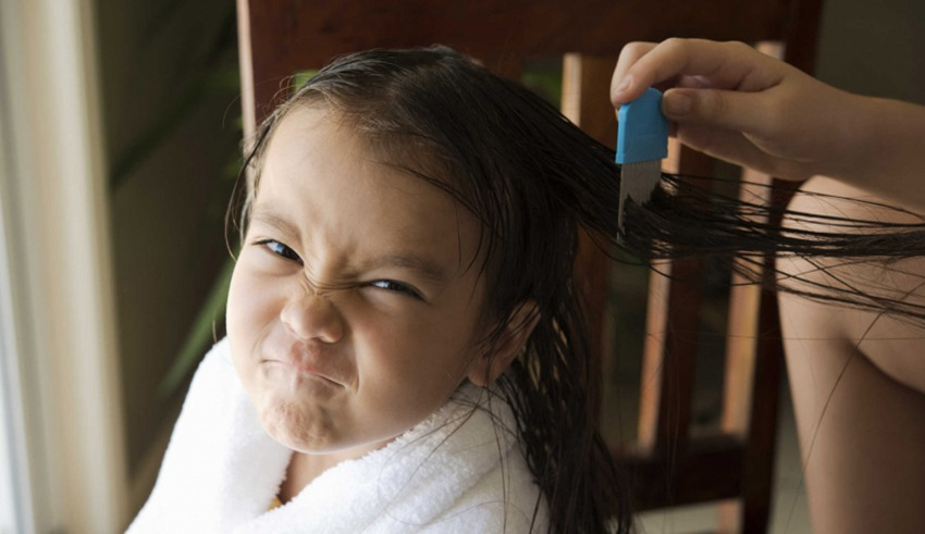 When To Consult A Professional For Lice Treatment